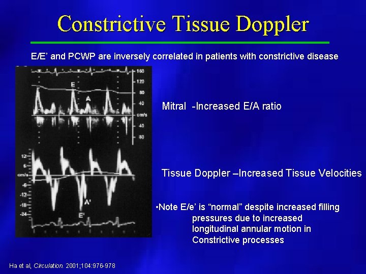 Constrictive Tissue Doppler E/E’ and PCWP are inversely correlated in patients with constrictive disease