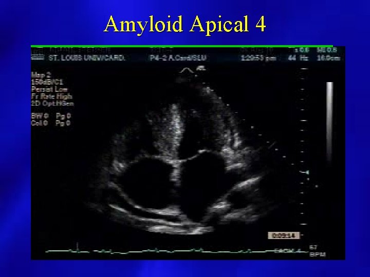 Amyloid Apical 4 