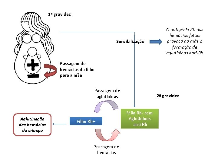 1ª gravidez Sensibilização O antigénio Rh das hemácias fetais provoca na mãe a formação