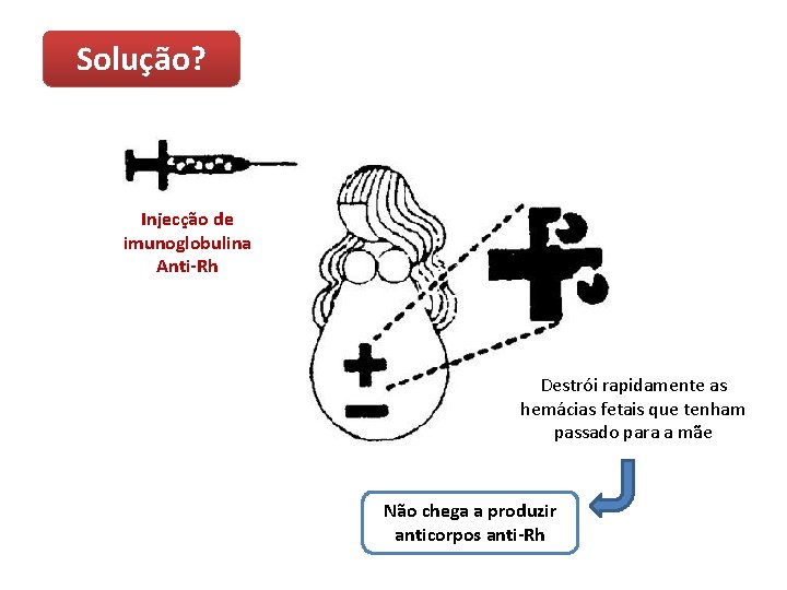 Solução? Injecção de imunoglobulina Anti-Rh Destrói rapidamente as hemácias fetais que tenham passado para