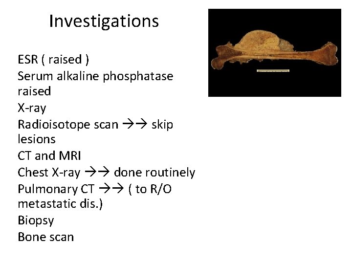 Investigations ESR ( raised ) Serum alkaline phosphatase raised X-ray Radioisotope scan skip lesions
