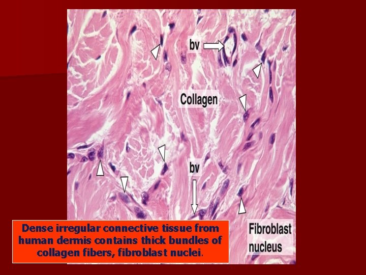 Dense irregular connective tissue from human dermis contains thick bundles of collagen fibers, fibroblast