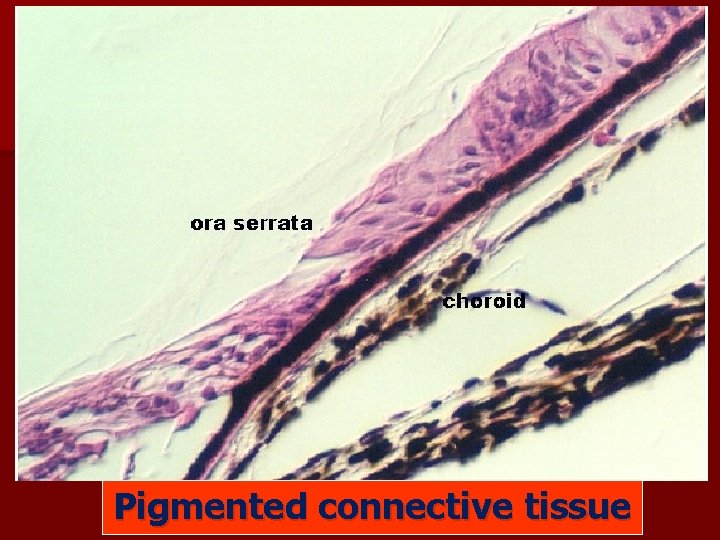 Pigmented connective tissue 