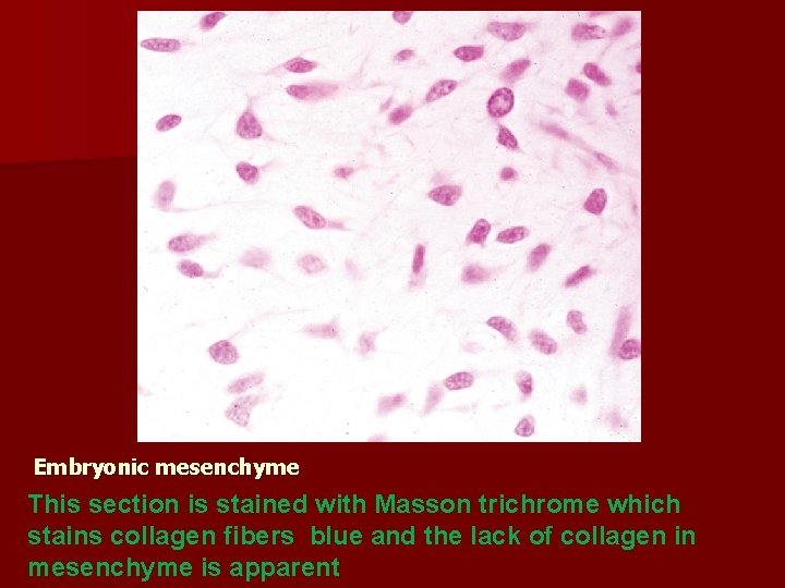 Embryonic mesenchyme This section is stained with Masson trichrome which stains collagen fibers blue