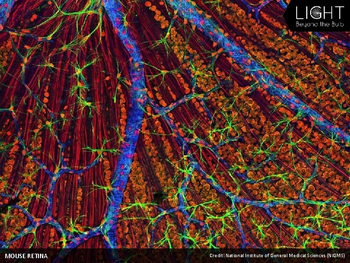 MOUSE RETINA Credit: National Institute of General Medical Sciences (NIGMS) 