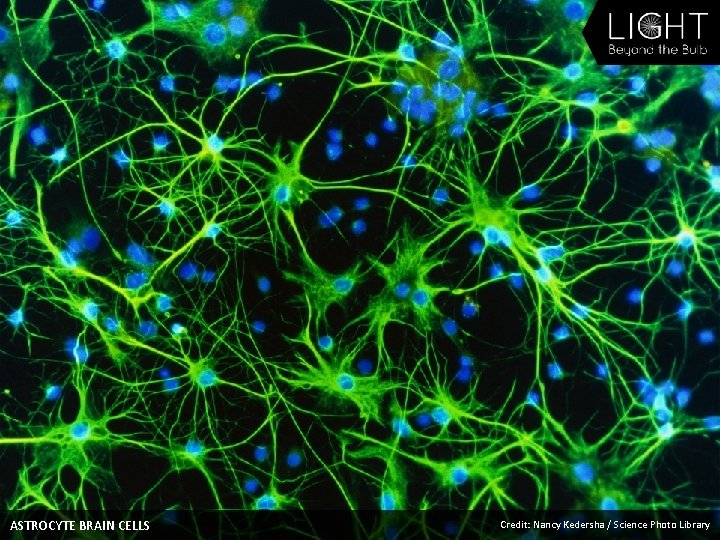 ASTROCYTE BRAIN CELLS Credit: Nancy Kedersha / Science Photo Library 