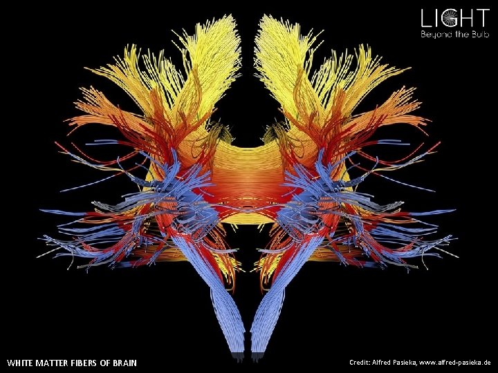 WHITE MATTER FIBERS OF BRAIN Credit: Alfred Pasieka, www. alfred-pasieka. de 