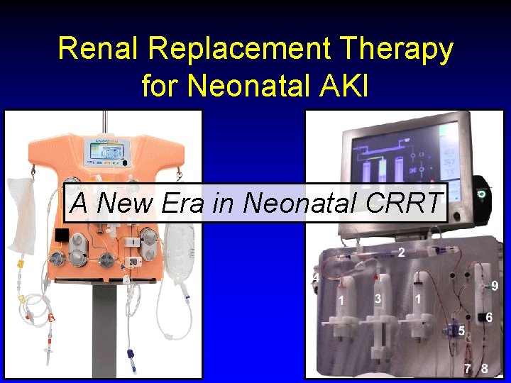 Renal Replacement Therapy for Neonatal AKI A New Era in Neonatal CRRT 