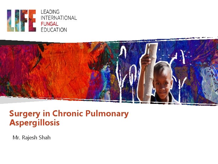 Surgery in Chronic Pulmonary Aspergillosis Mr. Rajesh Shah 