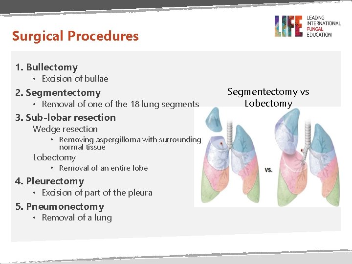 Surgical Procedures 1. Bullectomy • Excision of bullae 2. Segmentectomy • Removal of one