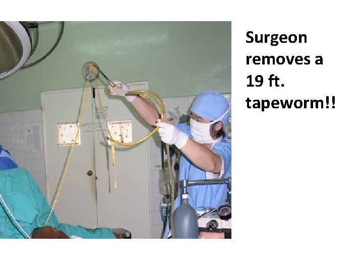 Surgeon removes a 19 ft. tapeworm!! 