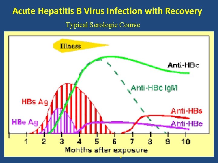 Acute Hepatitis B Virus Infection with Recovery Typical Serologic Course Symptoms HBe. Ag anti-HBe