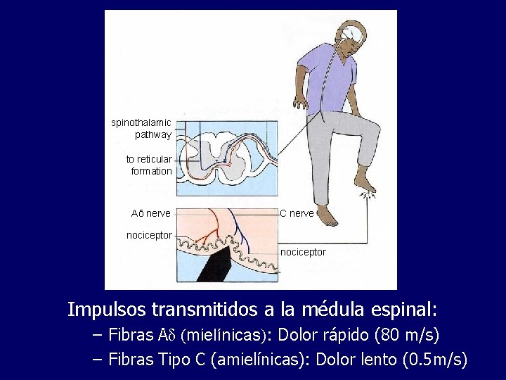 spinothalamic pathway to reticular formation Aδ nerve C nerve nociceptor Impulsos transmitidos a la