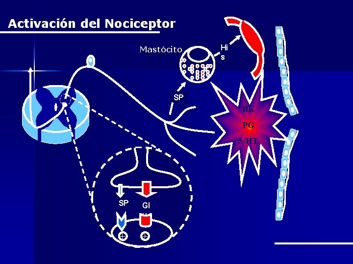 Activación del Nociceptor Mastócito Hi s SP BK PG 5 -HT SP Gl u