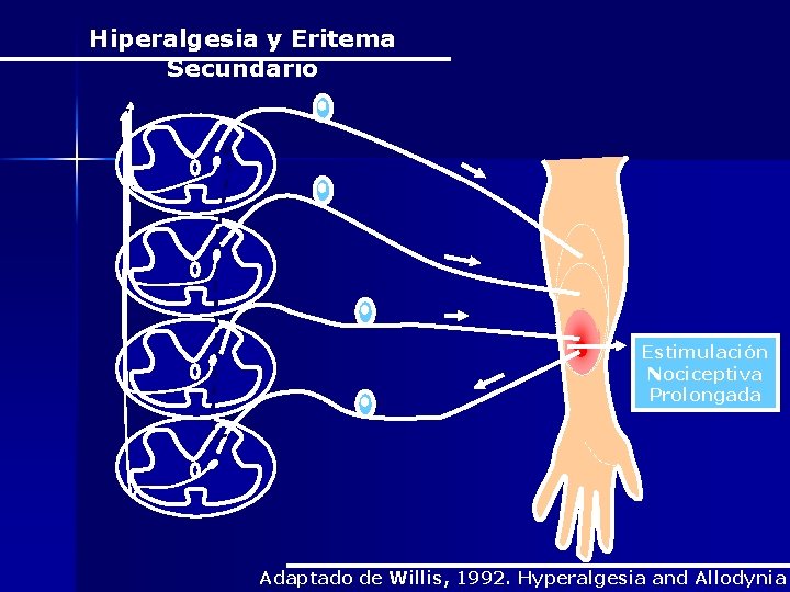 Hiperalgesia y Eritema Secundário Estimulación Nociceptiva Prolongada Adaptado de Willis, 1992. Hyperalgesia and Allodynia