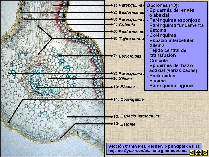 empalizada(13): 1: Parénquima en. Opciones - Epidermis del envés 2: Epidermis del envés o