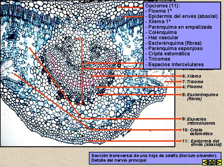 Opciones (11): 1: Colénquima - Floema 1º - Epidermis del envés (abaxial) 2: Parénquima