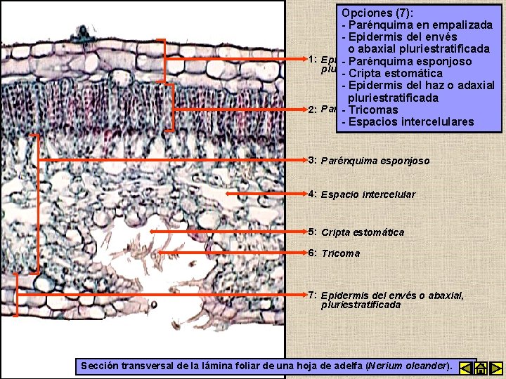 Opciones (7): - Parénquima en empalizada - Epidermis del envés o abaxial pluriestratificada 1: