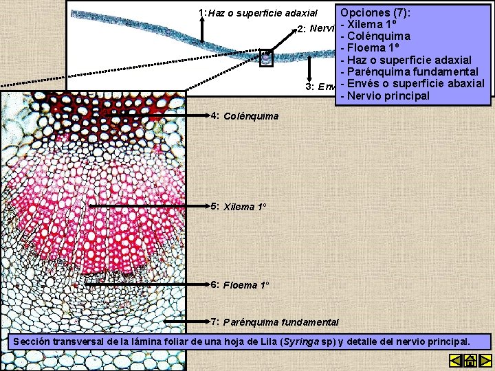Opciones (7): Xilema 1º 2: Nervio -principal - Colénquima - Floema 1º - Haz