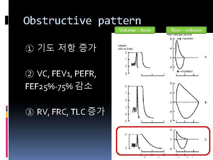 Obstructive pattern Volume – time ① 기도 저항 증가 ② VC, FEV 1, PEFR,