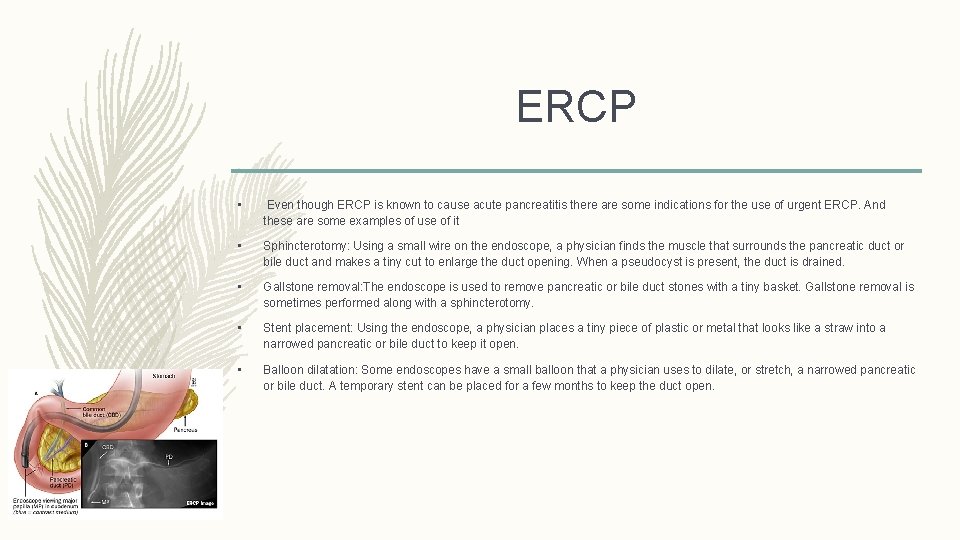 ERCP • Even though ERCP is known to cause acute pancreatitis there are some