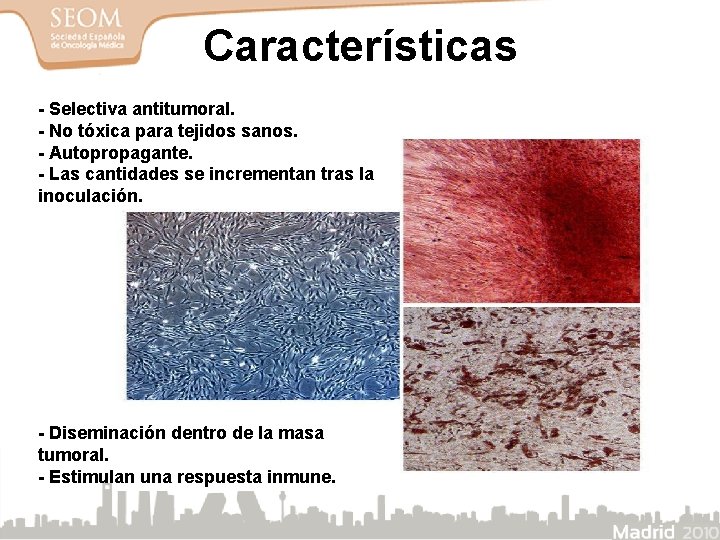 Características - Selectiva antitumoral. - No tóxica para tejidos sanos. - Autopropagante. - Las