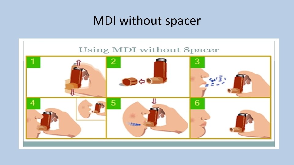 MDI without spacer 