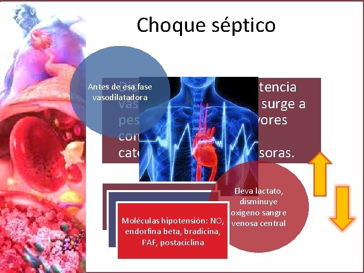 Choque séptico • Disminución de la resistencia vascular periférica que surge a pesar de