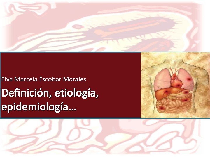 Elva Marcela Escobar Morales Definición, etiología, epidemiología… 