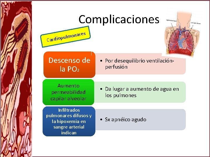 Complicaciones nares o m l u p Cardio Descenso de la PO 2 Aumento