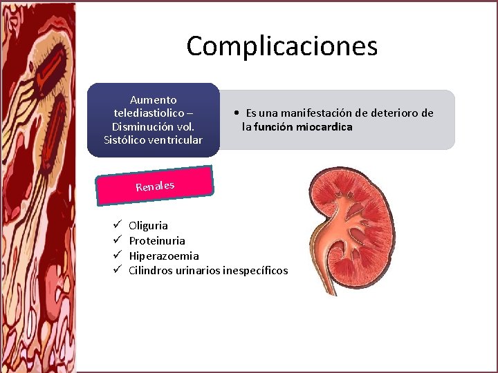 Complicaciones Aumento telediastiolico – Disminución vol. Sistólico ventricular • Es una manifestación de deterioro