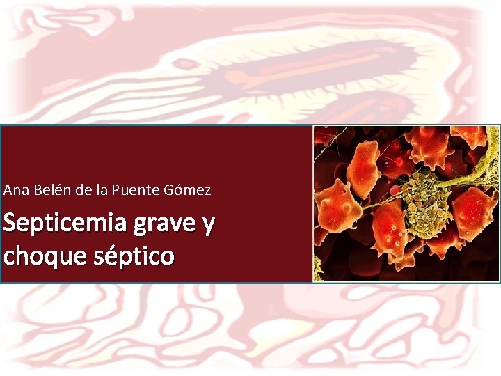 Ana Belén de la Puente Gómez Septicemia grave y choque séptico 