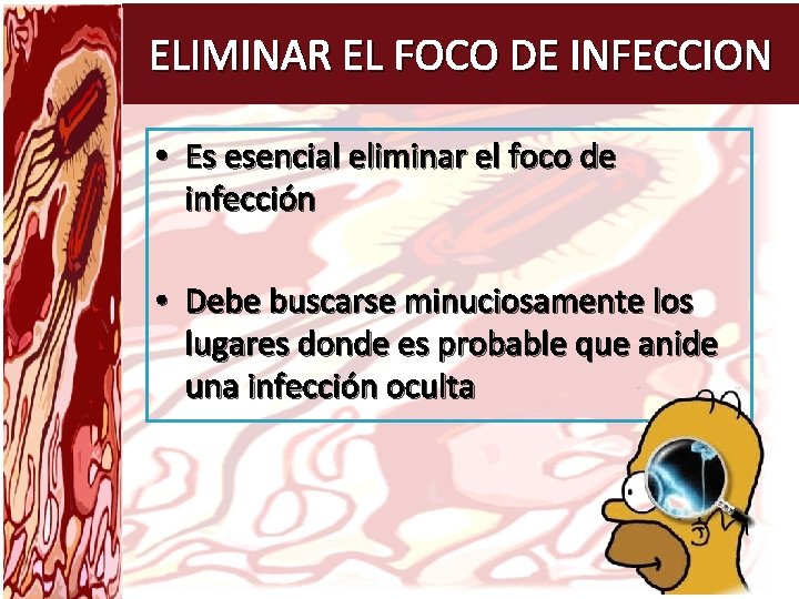 ELIMINAR EL FOCO DE INFECCION • Es esencial eliminar el foco de infección •