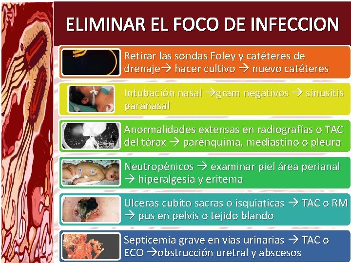 ELIMINAR EL FOCO DE INFECCION Retirar las sondas Foley y catéteres de drenaje hacer