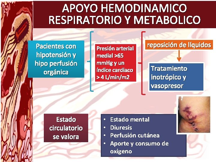APOYO HEMODINAMICO RESPIRATORIO Y METABOLICO Pacientes con hipotensión y hipo perfusión orgánica Estado circulatorio