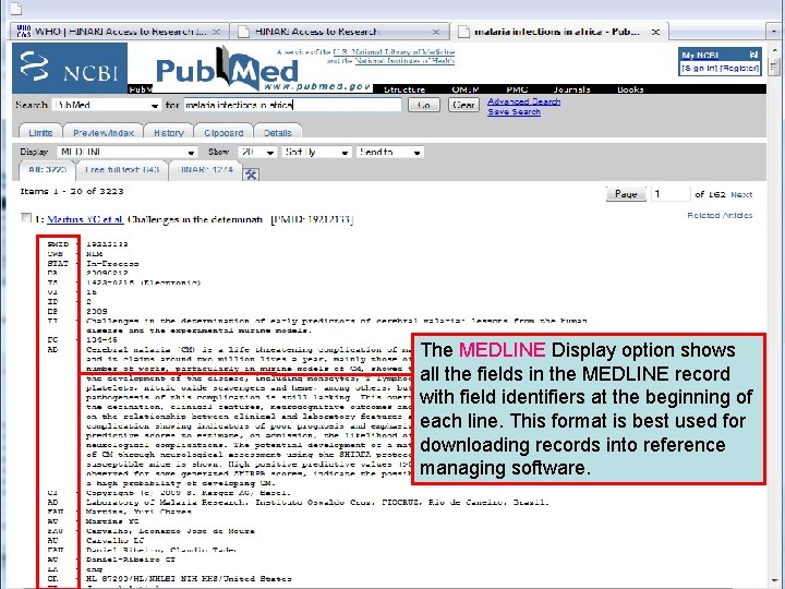 MEDLINE field identifiers The MEDLINE Display option shows all the fields in the MEDLINE