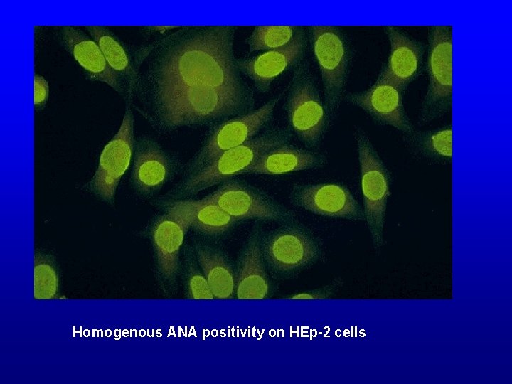 Homogenous ANA positivity on HEp-2 cells 