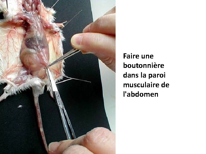 Faire une boutonnière dans la paroi musculaire de l'abdomen 