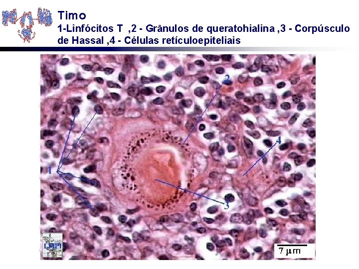 Timo 1 -Linfócitos T , 2 - Grânulos de queratohialina , 3 - Corpúsculo