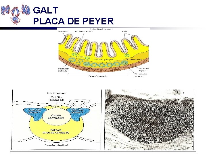 GALT PLACA DE PEYER 