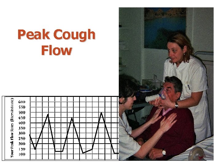 Peak Cough Flow 