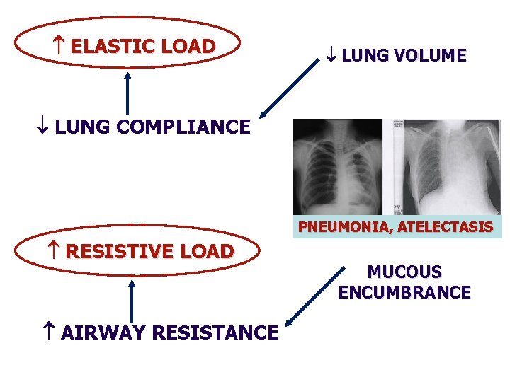  ELASTIC LOAD LUNG VOLUME LUNG COMPLIANCE PNEUMONIA, ATELECTASIS RESISTIVE LOAD AIRWAY RESISTANCE MUCOUS