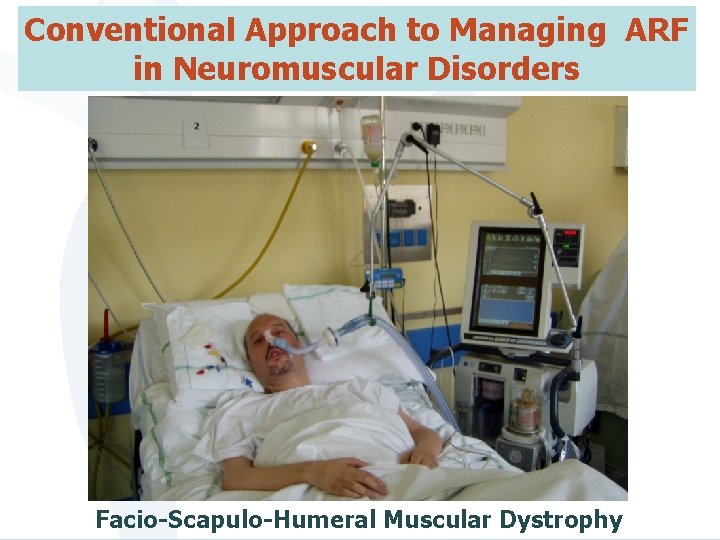 Conventional Approach to Managing ARF 20 | in Neuromuscular Disorders Facio-Scapulo-Humeral Muscular Dystrophy 
