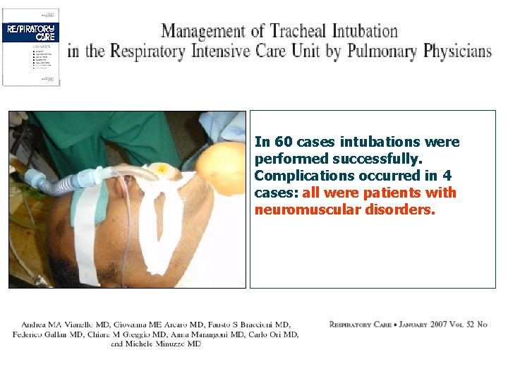 In 60 cases intubations were performed successfully. Complications occurred in 4 cases: all were