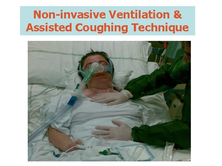 Non-invasive Ventilation & Assisted Coughing Technique 