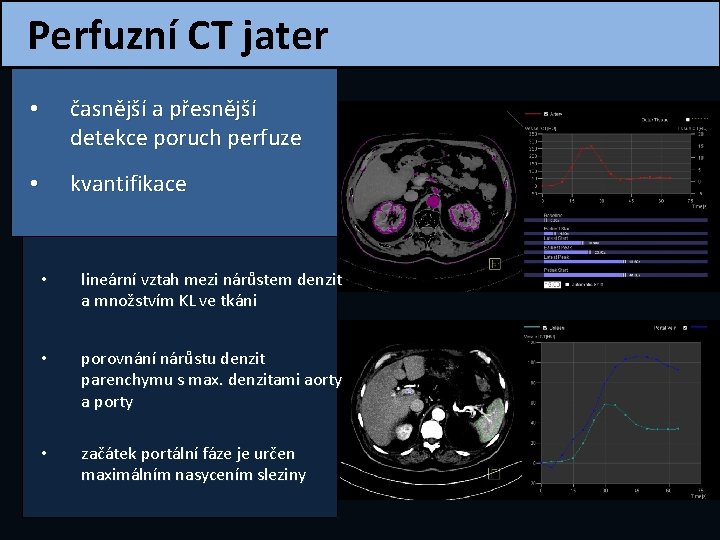 Perfuzní CT jater • časnější a přesnější detekce poruch perfuze • kvantifikace • lineární