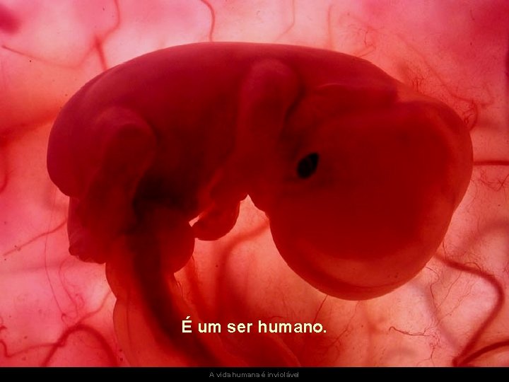 É um ser humano. A vida humana é inviolável 