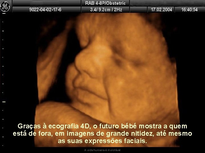 Graças à ecografia 4 D, o futuro bébé mostra a quem está de fora,