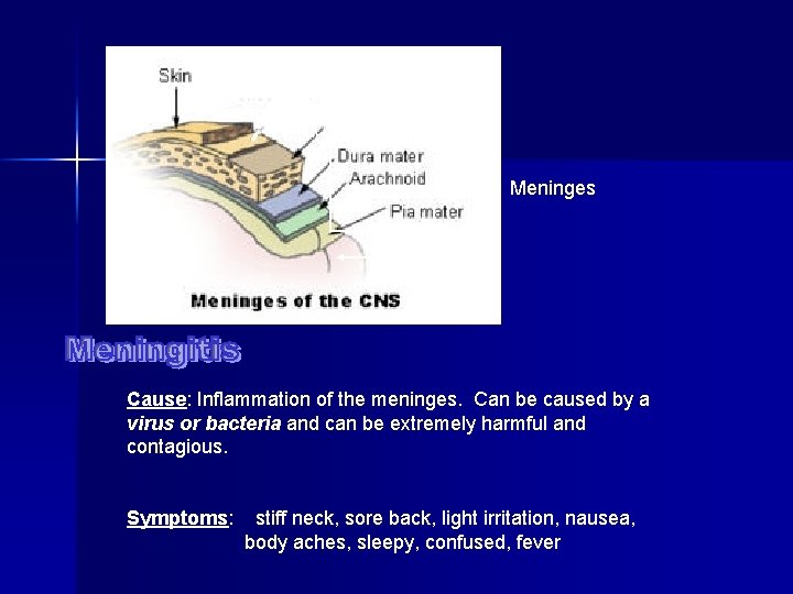 Skull bone Meninges brain Cause: Inflammation of the meninges. Can be caused by a