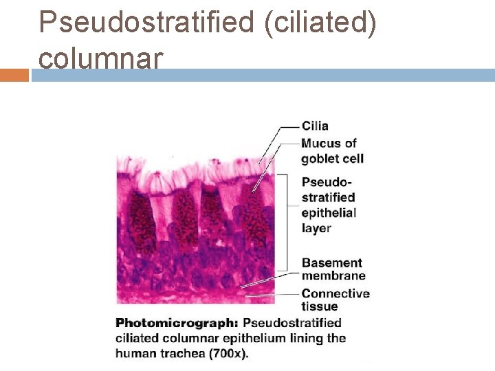 Pseudostratified (ciliated) columnar 